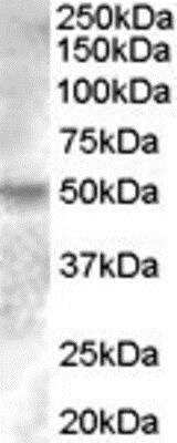 Western Blot: ERR gamma/NR3B3 Antibody [NBP1-00182]