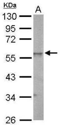 Western Blot: ERR gamma/NR3B3 Antibody [NBP1-32853]
