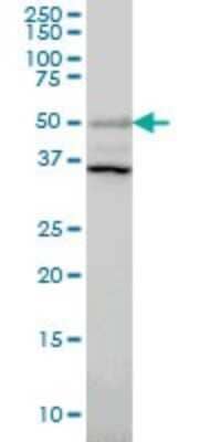 Western Blot: ERRFI1 Antibody (2B9) [H00054206-M01]