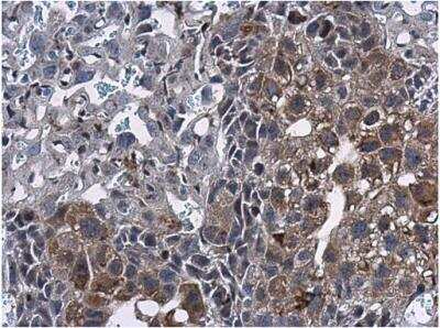 Immunohistochemistry-Paraffin: ERRFI1 Antibody [NBP2-16372]