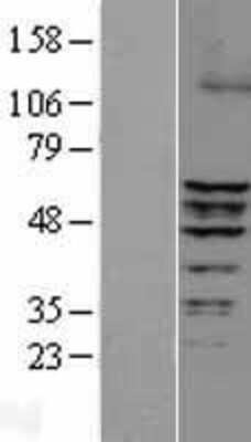 Western Blot: ERRFI1 Overexpression Lysate [NBL1-10339]