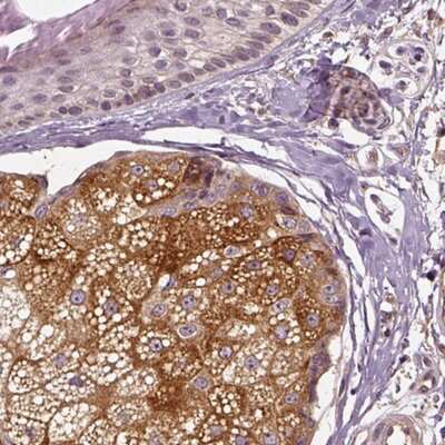 Immunohistochemistry-Paraffin: ERV3-1 Antibody [NBP2-68667]