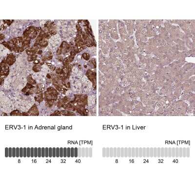 Immunohistochemistry-Paraffin: ERV3-1 Antibody [NBP2-62602]