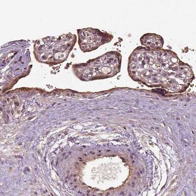 Immunohistochemistry-Paraffin: ERV3-1 Antibody [NBP2-62602]