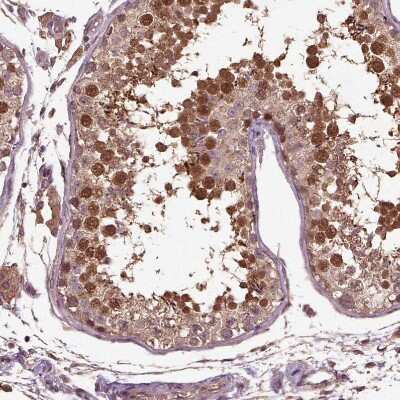 Immunohistochemistry-Paraffin: ERV3-1 Antibody [NBP2-62602]