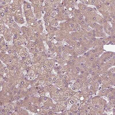 Immunohistochemistry-Paraffin: ERV3-1 Antibody [NBP2-62602]