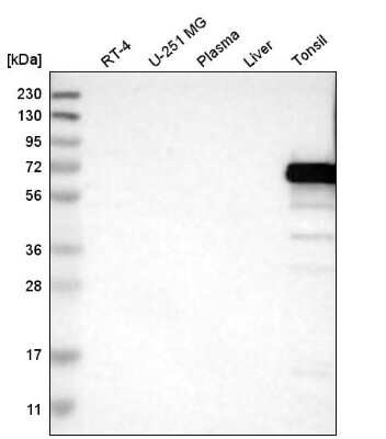 Western Blot: ERV3-1 Antibody [NBP2-62602]