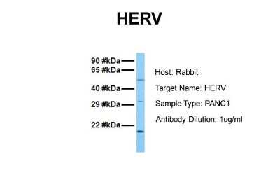 Western Blot: ERVFRD-1 Antibody [NBP1-79613]