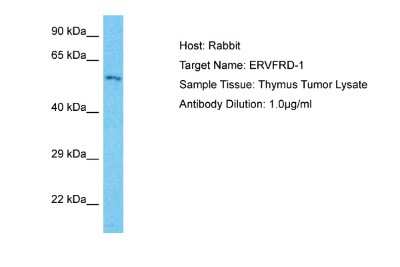 Western Blot: ERVFRD-1 Antibody [NBP2-84020]