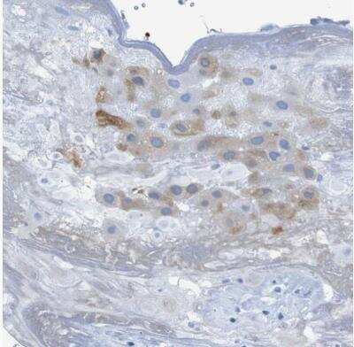 Immunohistochemistry-Paraffin: ERVMER34-1 Antibody [NBP2-14484]