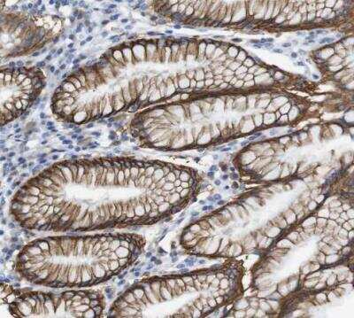 Immunohistochemistry-Paraffin: ERVMER34-1 Antibody [NBP2-14484]