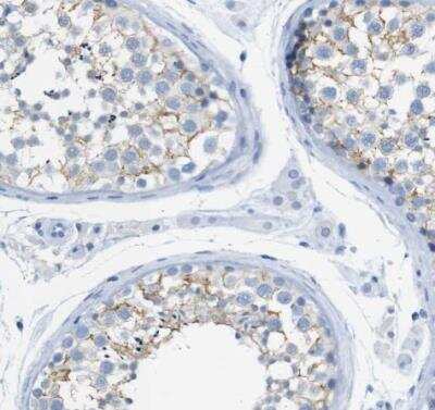 Immunohistochemistry-Paraffin: ERVMER34-1 Antibody [NBP2-14484]