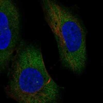 Immunocytochemistry/ Immunofluorescence: ERVV-1 Antibody [NBP3-17159]