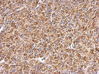Immunohistochemistry-Paraffin: ERp57/PDIA3 Antibody [NBP2-16369]