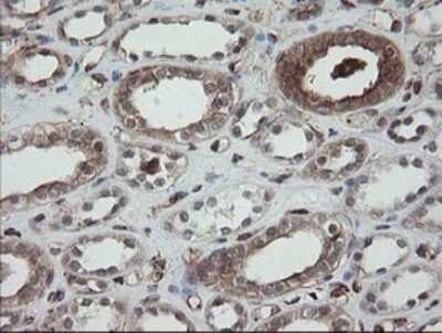 Immunohistochemistry: ERp57/PDIA3 Antibody (OTI3E1) [NBP2-46362]
