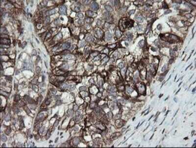 Immunohistochemistry: ERp57/PDIA3 Antibody (OTI3E1) [NBP2-46362]