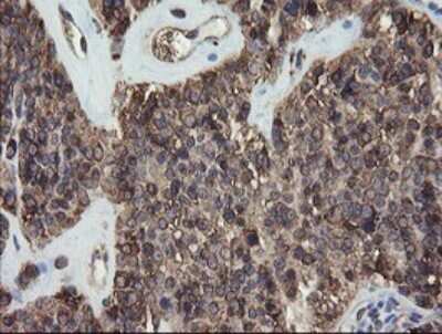 Immunohistochemistry: ERp57/PDIA3 Antibody (OTI3E1) [NBP2-46362]