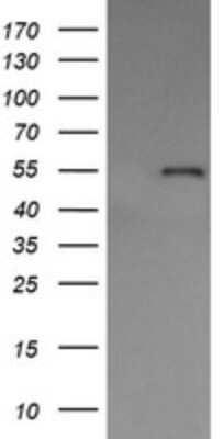 Western Blot: ERp57/PDIA3 Antibody (OTI3E1) [NBP2-46362]