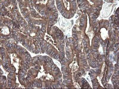 Immunohistochemistry: ERp57/PDIA3 Antibody (OTI4D7) [NBP2-46369]