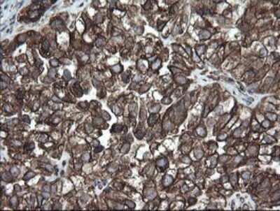Immunohistochemistry: ERp57/PDIA3 Antibody (OTI4D7) [NBP2-46369]