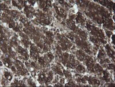 Immunohistochemistry: ERp57/PDIA3 Antibody (OTI4D7) [NBP2-46369]