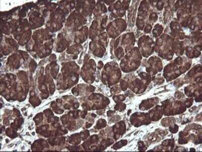 Immunohistochemistry: ERp57/PDIA3 Antibody (OTI4D7) [NBP2-46369]