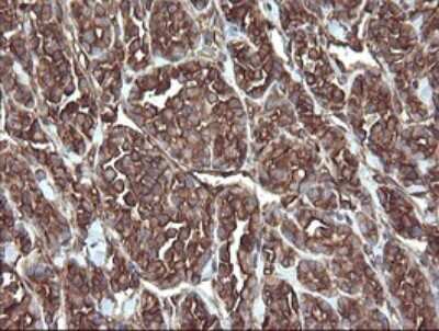 Immunohistochemistry: ERp57/PDIA3 Antibody (OTI4D7) [NBP2-46369]