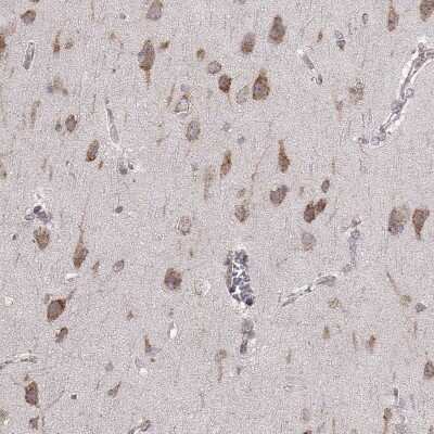 Immunohistochemistry-Paraffin: ERp57/PDIA3 Antibody (CL2444) [NBP2-36765]