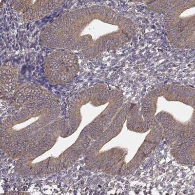 Immunohistochemistry-Paraffin: ERp57/PDIA3 Antibody (CL2444) [NBP2-36765]