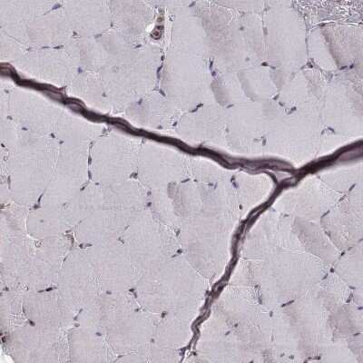 Immunohistochemistry-Paraffin: ERp57/PDIA3 Antibody (CL2444) [NBP2-36765]
