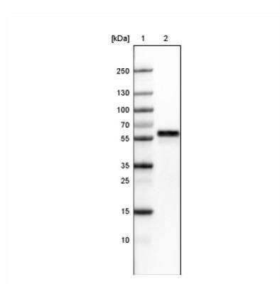 Western Blot: ERp57/PDIA3 Antibody (CL2444) [NBP2-36765]