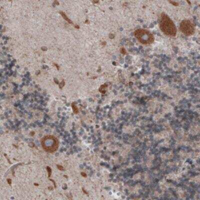 Immunohistochemistry: ERp57/PDIA3 Antibody (CL2446) [NBP2-36766]