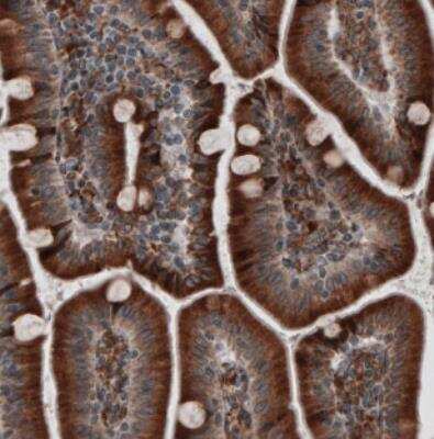 Immunohistochemistry: ERp57/PDIA3 Antibody (CL2446) [NBP2-36766]