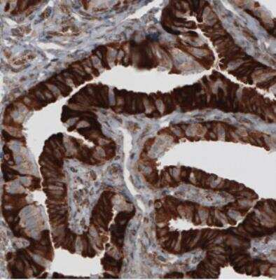 Immunohistochemistry: ERp57/PDIA3 Antibody (CL2446) [NBP2-36766]