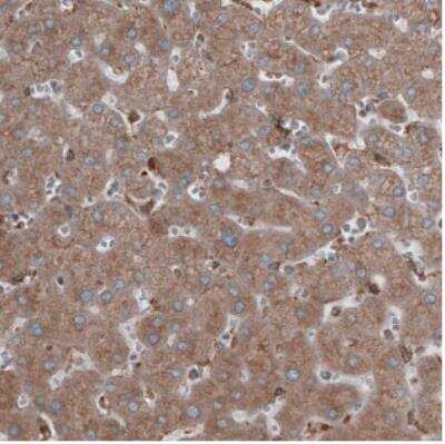 Immunohistochemistry: ERp57/PDIA3 Antibody (CL2446) [NBP2-36766]