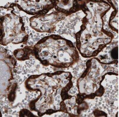 Immunohistochemistry: ERp57/PDIA3 Antibody (CL2446) [NBP2-36766]