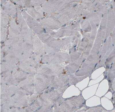 Immunohistochemistry: ERp57/PDIA3 Antibody (CL2446) [NBP2-36766]