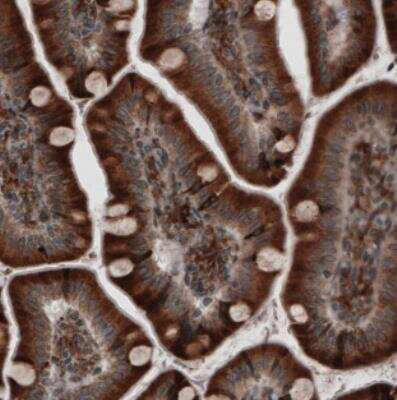 Immunohistochemistry: ERp57/PDIA3 Antibody (CL2452) [NBP2-36767]