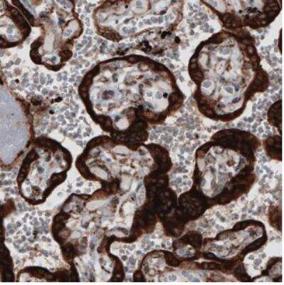 Immunohistochemistry: ERp57/PDIA3 Antibody (CL2452) [NBP2-36767]