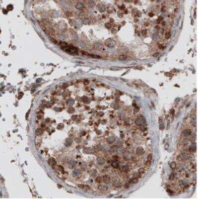 Immunohistochemistry: ERp57/PDIA3 Antibody (CL2452) [NBP2-36767]