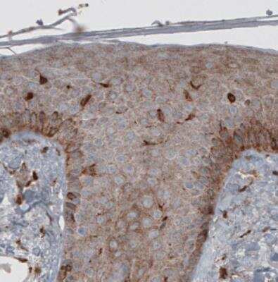 Immunohistochemistry: ERp57/PDIA3 Antibody (CL2452) [NBP2-36767]