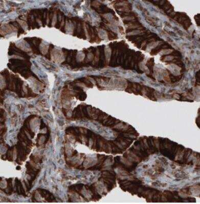 Immunohistochemistry: ERp57/PDIA3 Antibody (CL2452) [NBP2-36767]