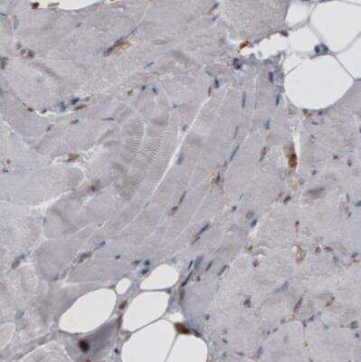 Immunohistochemistry: ERp57/PDIA3 Antibody (CL2452) [NBP2-36767]