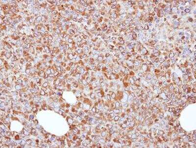 Immunohistochemistry-Paraffin: ERp57/PDIA3 Antibody [NB100-78614]