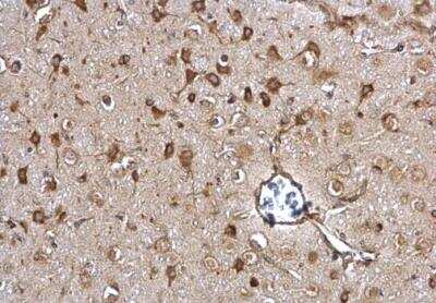 Immunohistochemistry-Paraffin: ERp57/PDIA3 Antibody [NB100-78614]
