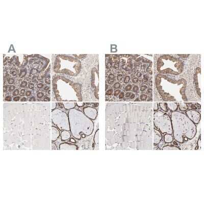 Immunohistochemistry-Paraffin: ERp57/PDIA3 Antibody [NBP1-84796]