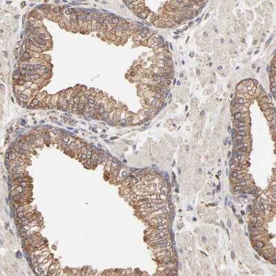 Immunohistochemistry-Paraffin: ERp57/PDIA3 Antibody [NBP1-84796]