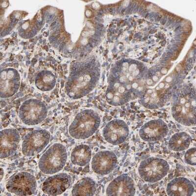 Immunohistochemistry-Paraffin: ERp57/PDIA3 Antibody [NBP1-84796]