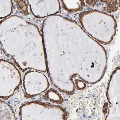 Immunohistochemistry-Paraffin: ERp57/PDIA3 Antibody [NBP1-84796]