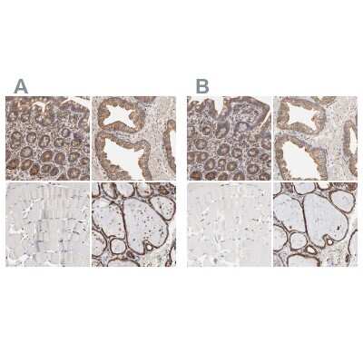 Immunohistochemistry-Paraffin: ERp57/PDIA3 Antibody [NBP1-84797]
